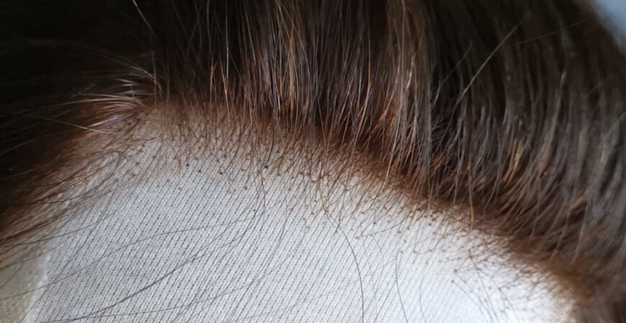 生え際を自然に見せるウィッグの3つポイント 永佳髪製品工場